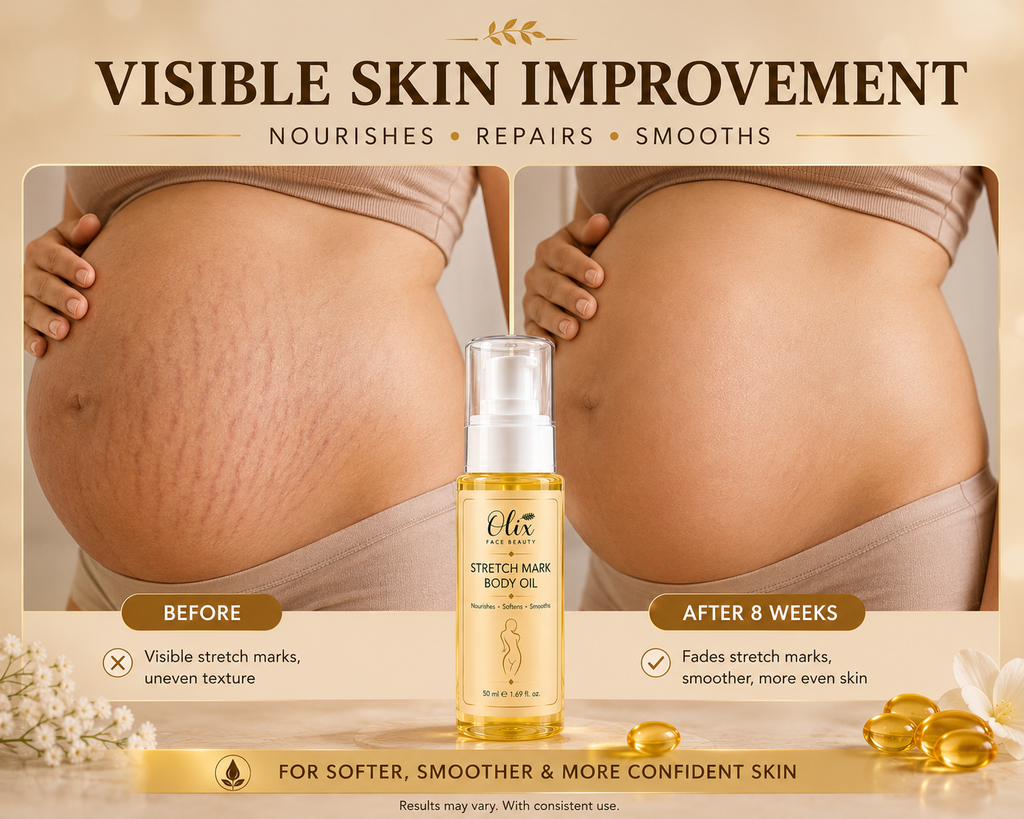 Stretch Mark Body Oil